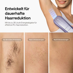 Ulike Air 10 IPL Saphir-Eiskühlungs-IPL-Haarentfernungsgerät